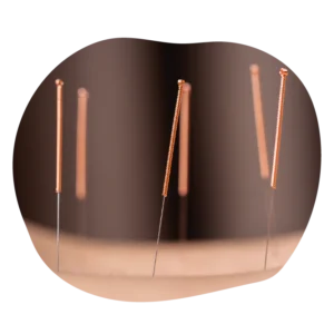 WeSlimmer Scalp Acupuncture 16 with 1000 needles